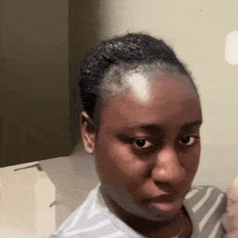 Revitalize Your Confidence with Luscious, Healthy Hair!